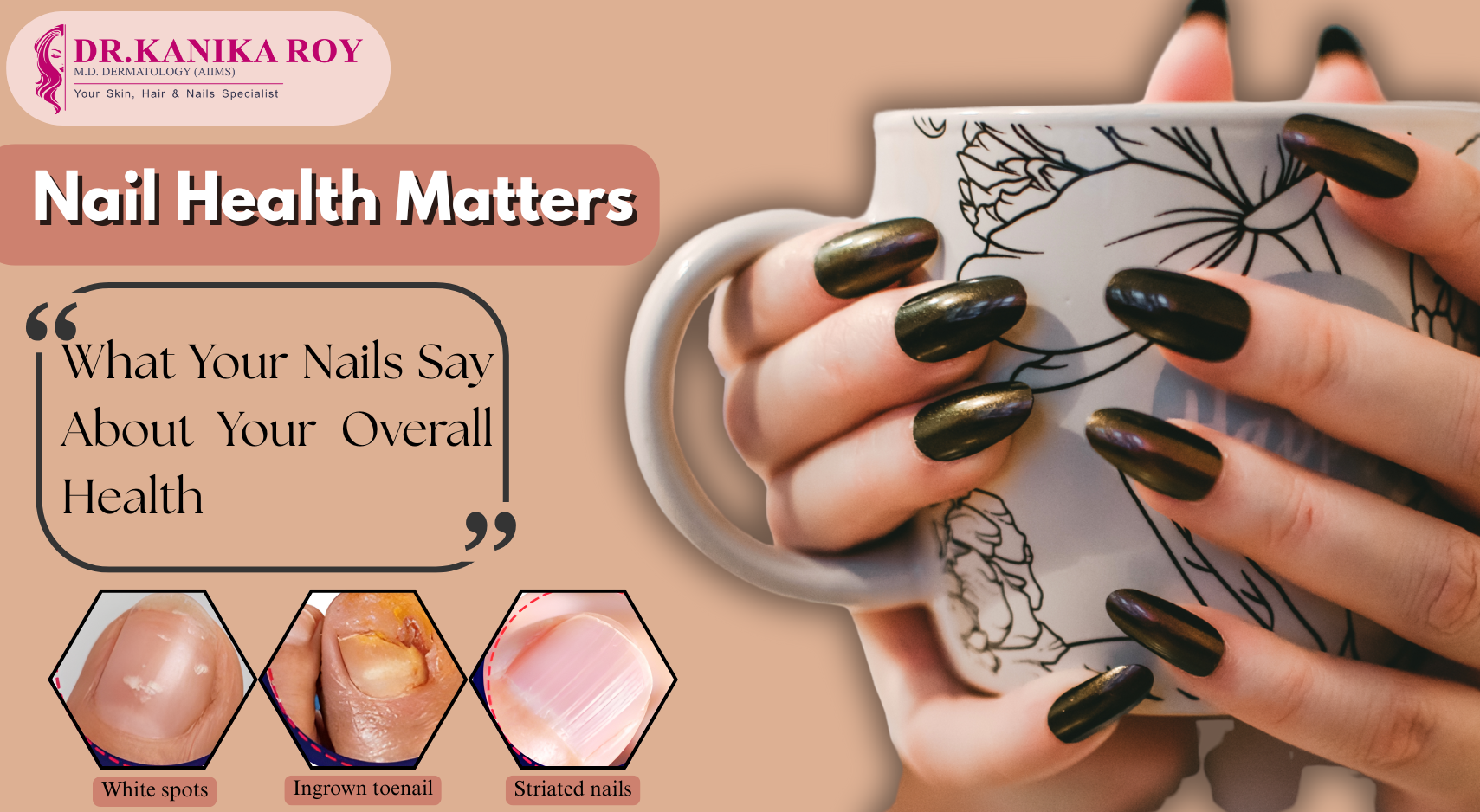 What Your Nails Say About Your Overall Health